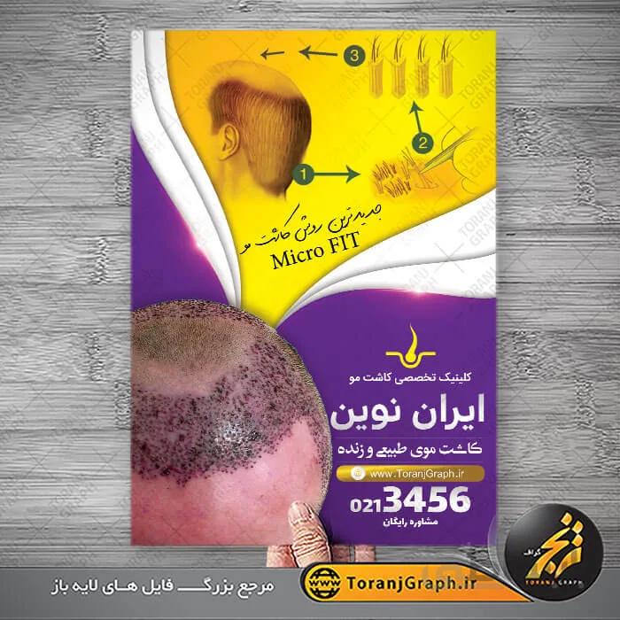 تراکت لایه باز کاشت مو