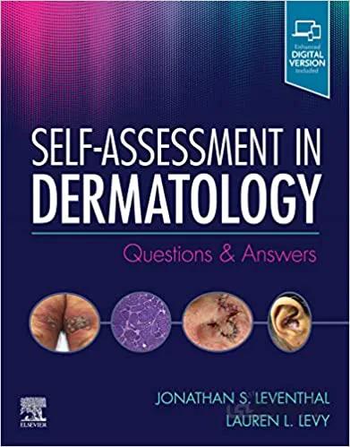 دانلود کتاب Self-Assessment in Dermatology: Questions and Answers [2020] - Epub + Converted Pdf