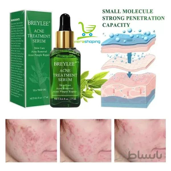 سرم ضد جوش و آکنه چای سبز بریلی BREYLEE