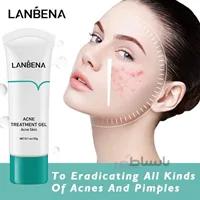 ژل درمانی ضد جوش لانبنا ا Gel therapy