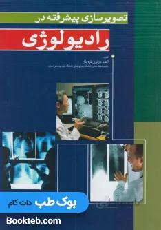 تصویرسازی پیشرفته در رادیولوژی