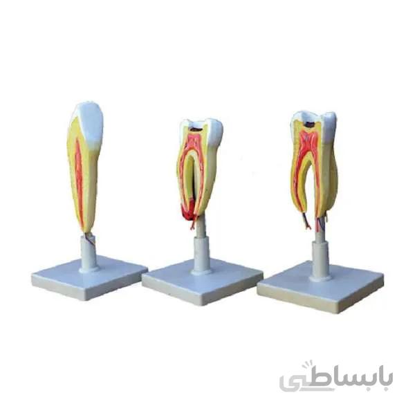 مولاژ 3 مرحله ای دندان
