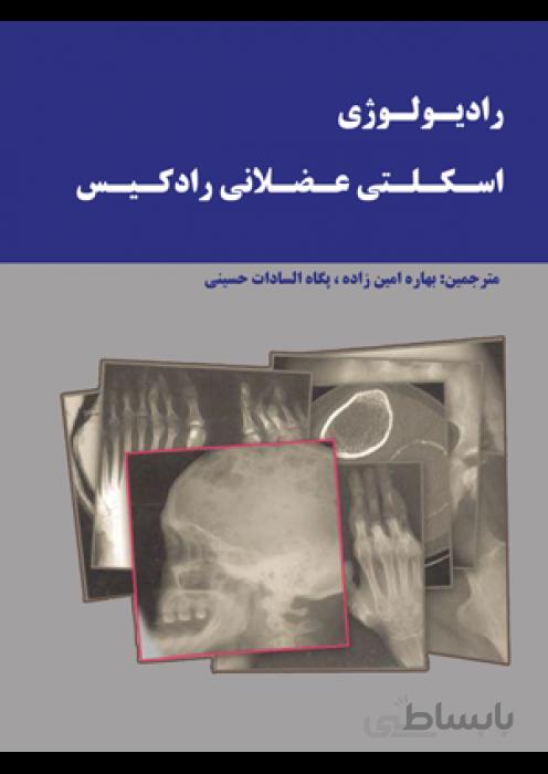 رادیولوژی اسکلتی عضلانی رادکیس