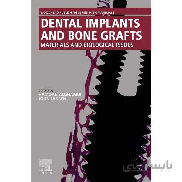 Dental Implants and Bone Grafts: Materials and Biological Issues 1st Edition