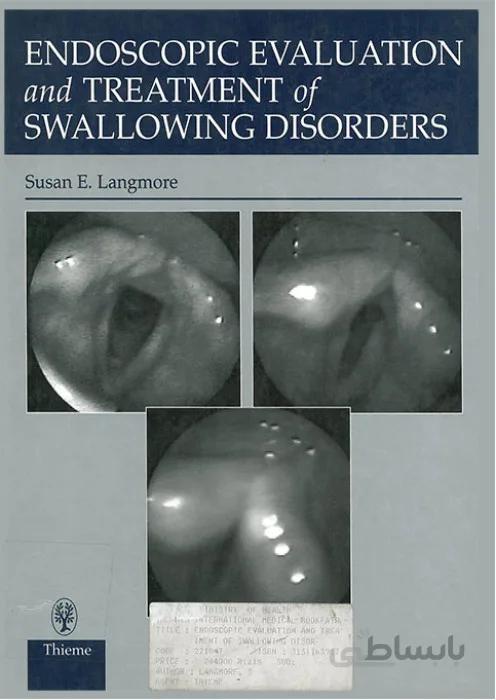 Endoscopic Evaluation and Treatment of Swallowing Disorders