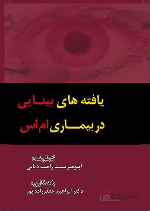 یافته های بینایی در بیماری ام اس