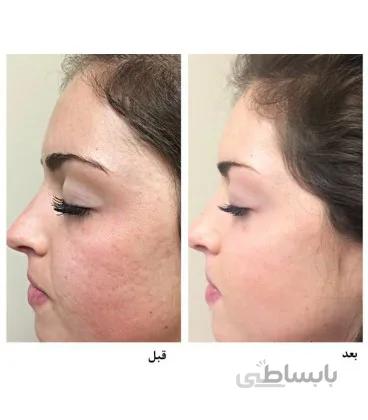 کوکتل رجنریتینگ توسکانی Toskani Regenerating cocktail