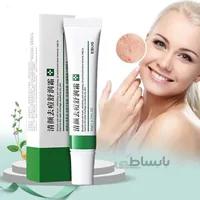 کرم ضد جوش ابوگ ضد آکنه EBUG