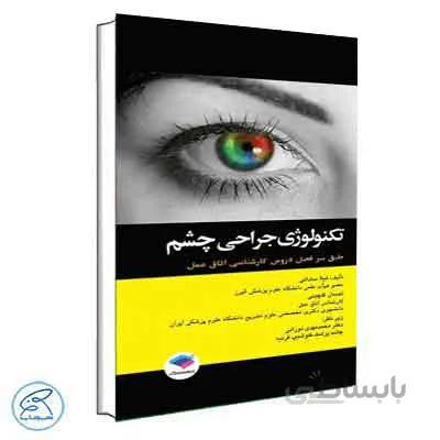 تکنولوژی جراحی چشم ساداتی و گلچینی | جامعه نگر