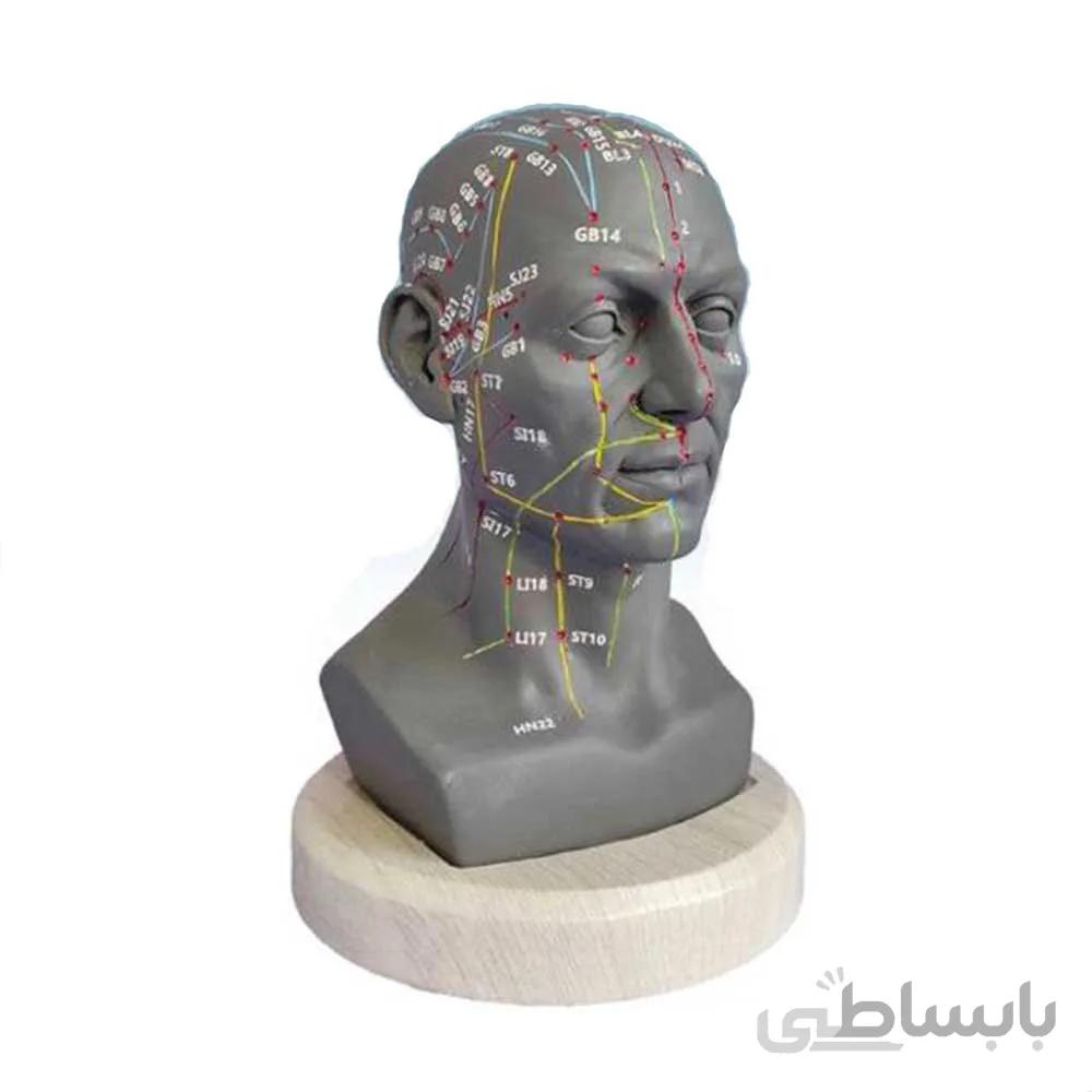 مولاژ طب سوزنی سر