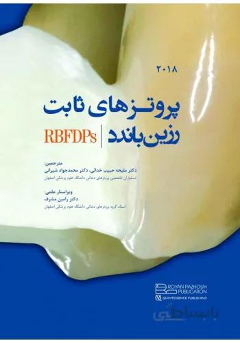 پروتزهای ثابت رزین باندد ۲۰۱۸ – RBFDPs