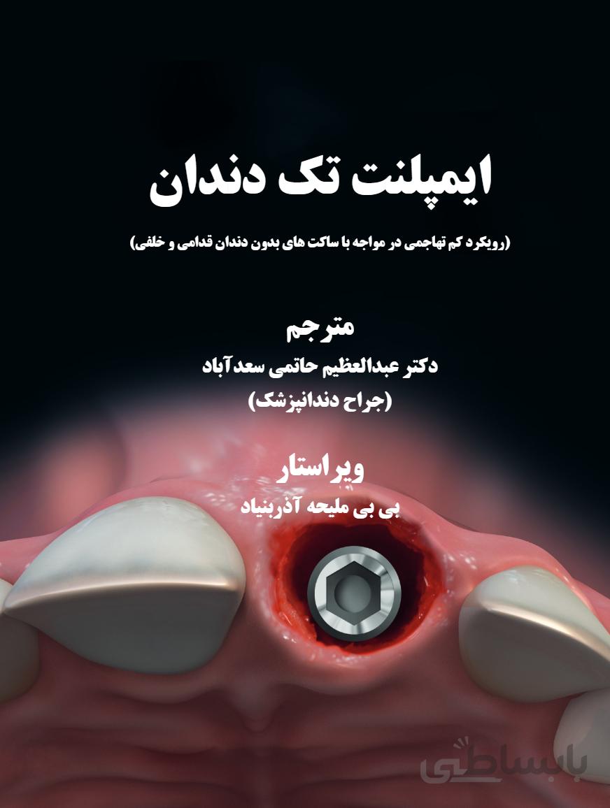 ایمپلنت تک دندان ۲۰۲۰