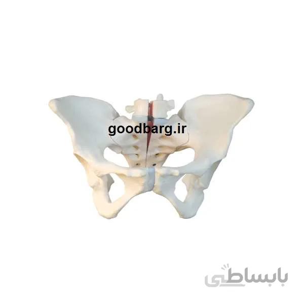مولاژ لگن خاصره