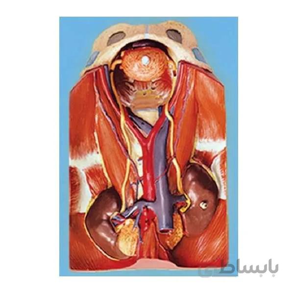 مولاژ کلیه تفکیکی