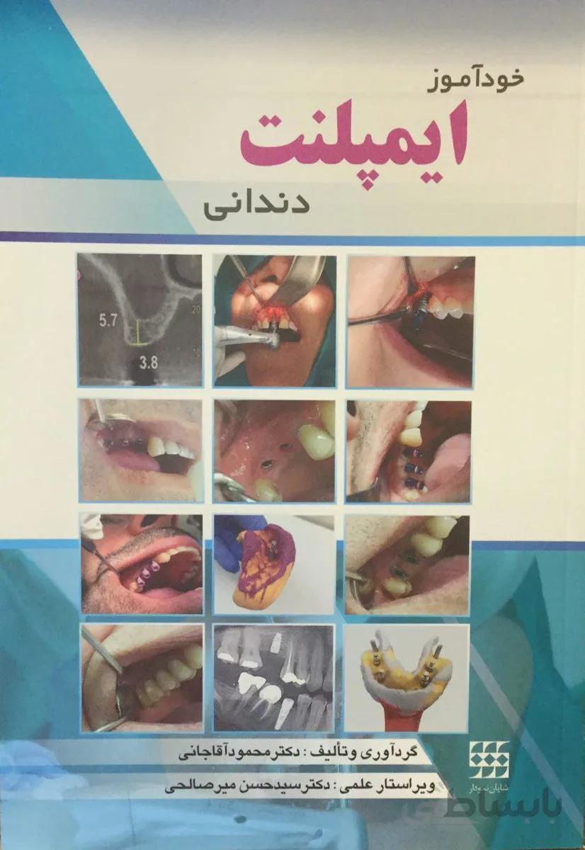 خودآموز ایمپلنت دندانی