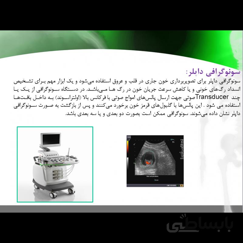 پاورپوینت آماده اثر سونوگرافی داپلر در تشخیص گرفتگی عروق