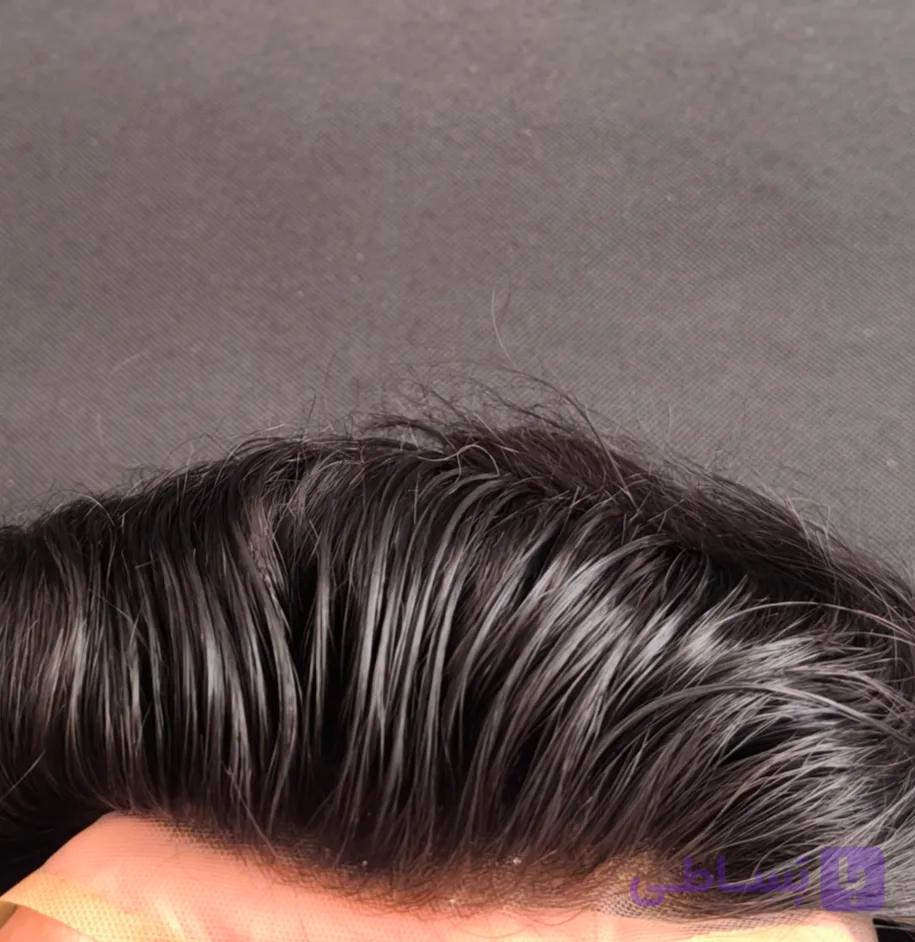 پروتز مو سینمایی جلوتور آنکارایی بلیچ اورجینال 17x23 رنگ N2