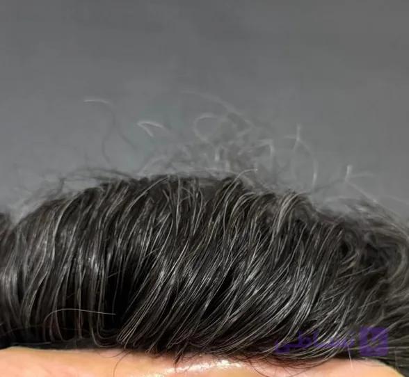 پروتز مو دورسیلیکون نیوزلندی اورجینال 25x18 رنگ 20 درصد سفیدی