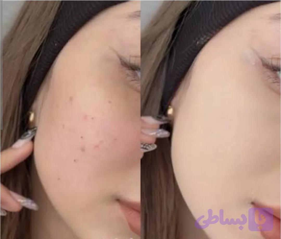 ⭕️پنکک گابرینی ⭕️اورجینال (محصول ترکیه) ☑️
