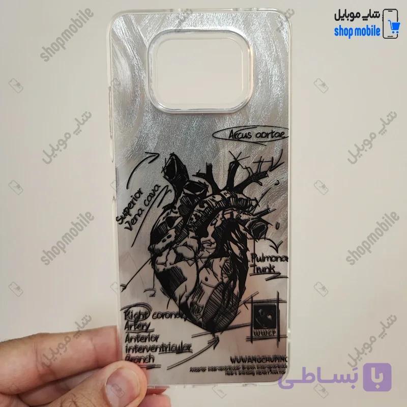 قاب گوشی شیائومی پوکو X3 / X3 پرو / X3 NFC (کاور IMD براش طرح آناتومی قلب Silver) — تصویر 1