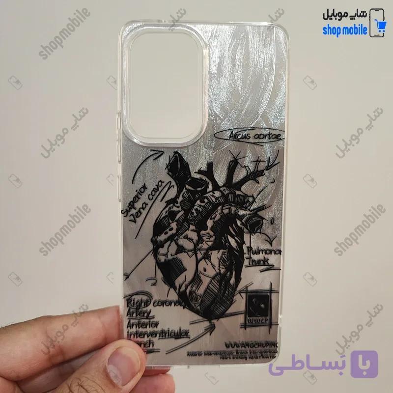 قاب گوشی سامسونگ گلکسی A15 (کاور IMD براش طرح آناتومی قلب Silver) — تصویر 1