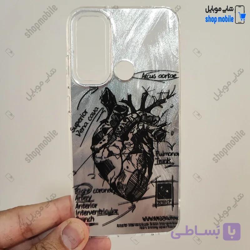 قاب گوشی شیائومی ردمی نوت 12S (کاور IMD براش طرح آناتومی قلب Silver) — تصویر 1