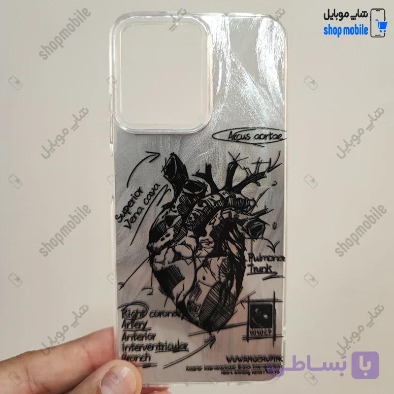 قاب گوشی شیائومی ردمی نوت 14 پرو 5G / نوت 14 پرو پلاس / پوکو X7 (کاور IMD براش طرح آناتومی قلب Silver) — تصویر 1