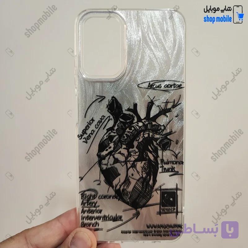 قاب گوشی سامسونگ گلکسی A06 (کاور IMD براش طرح آناتومی قلب Silver) — تصویر 1