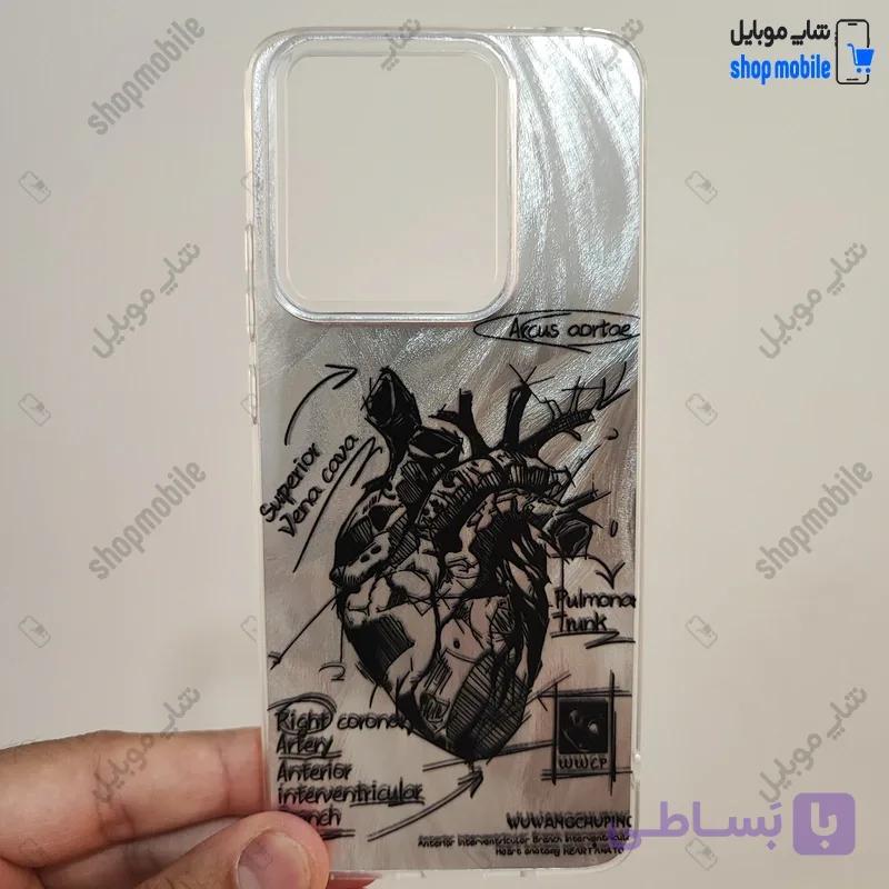 قاب گوشی شیائومی ردمی 13C / پوکو C65 (کاور IMD براش طرح آناتومی قلب Silver) — تصویر 1
