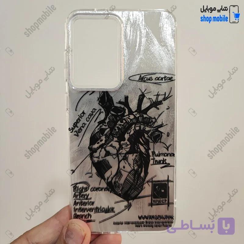 قاب گوشی شیائومی ردمی نوت 14S (کاور IMD براش طرح آناتومی قلب Silver) — تصویر 1