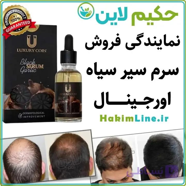 سرم سیر سیاه اصل، درمان قطعی ریزش مو (نمایندگی رسمی فروش) — تصویر 1