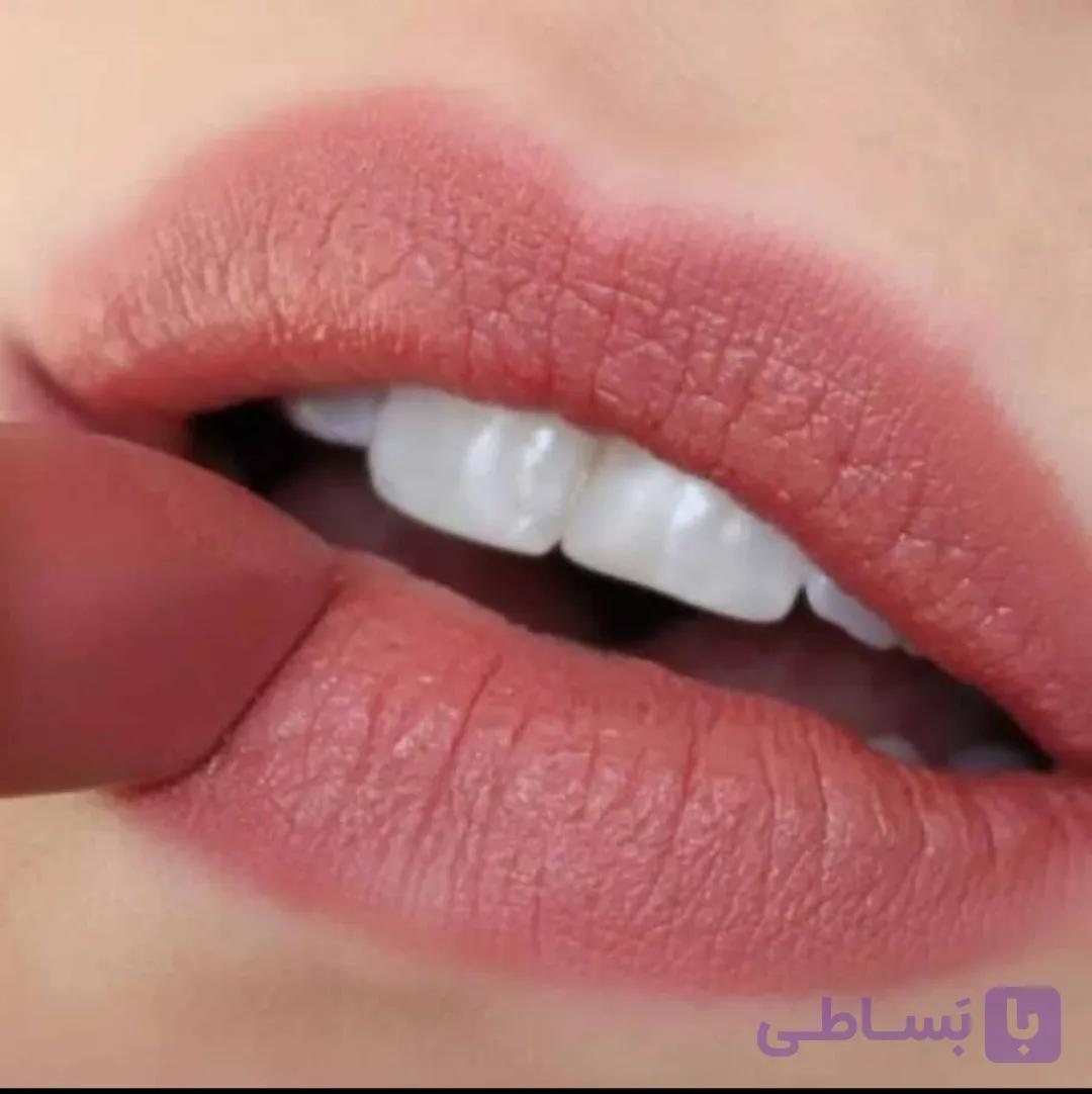 رژلب جامد ال پی 13 — تصویر 1