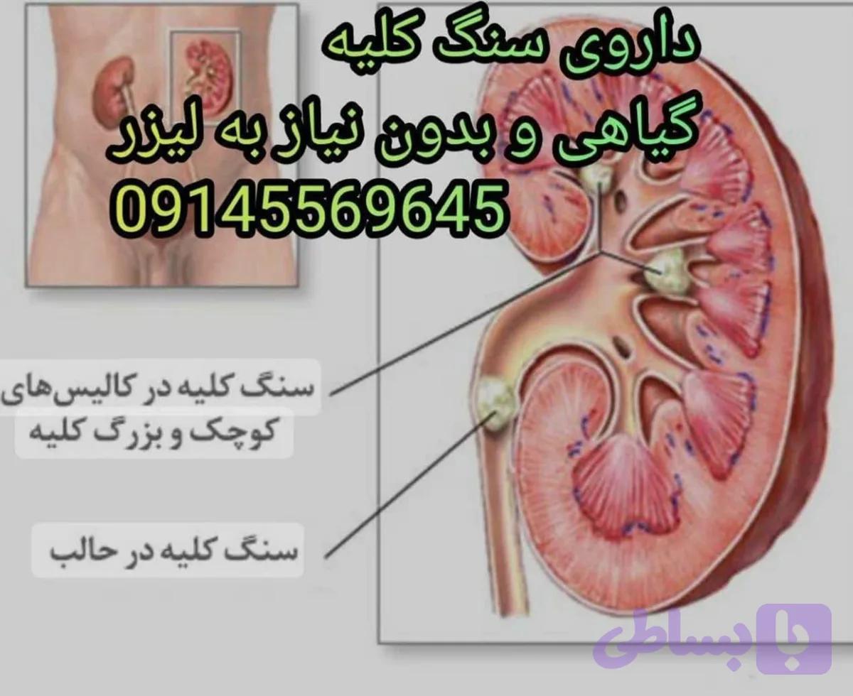 داروی سنگ کلیه