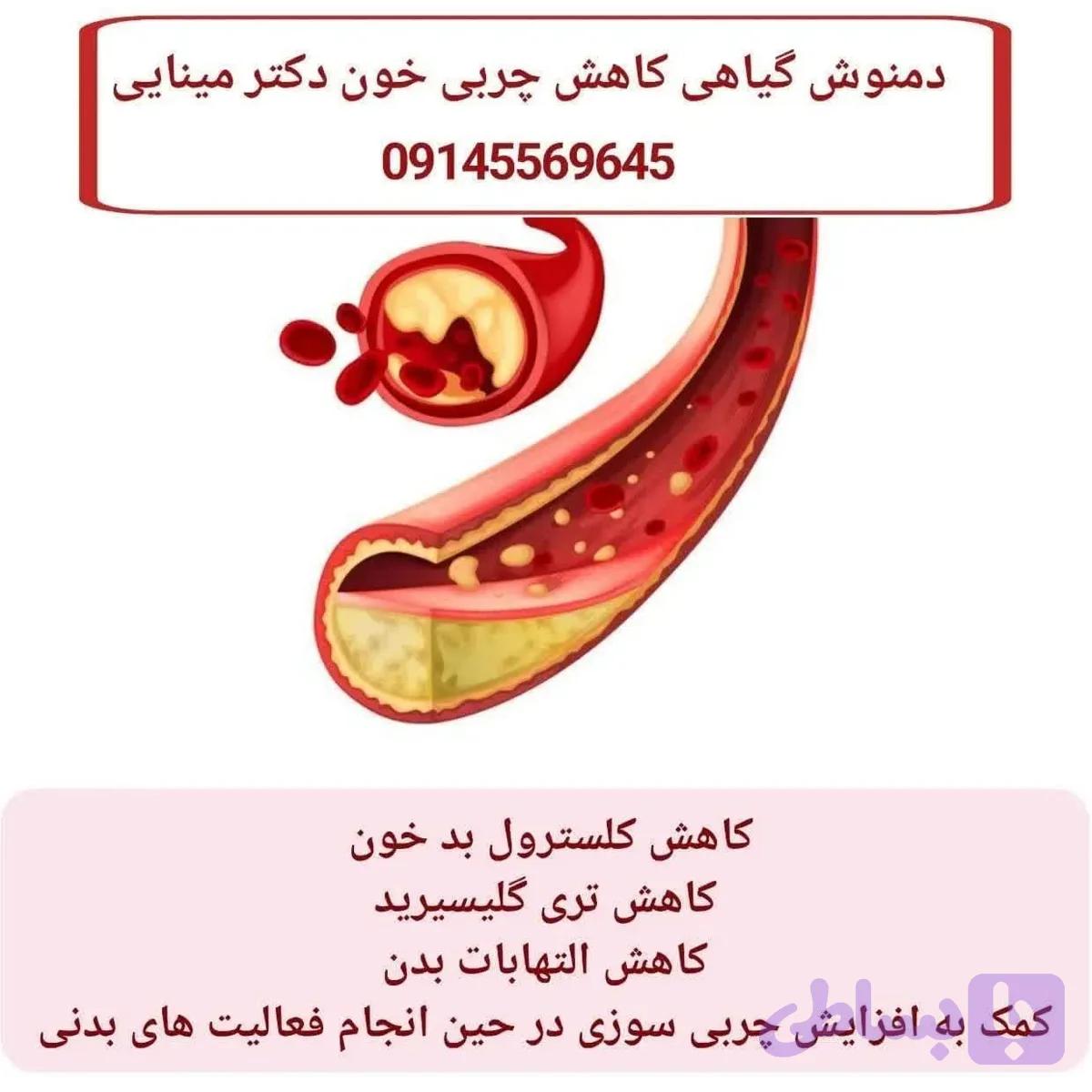 داروی کاهش چربی خون