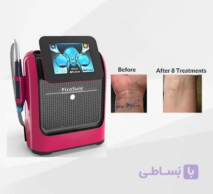 دستگاه لیزر کیوسوییچ پیکوشور پیکوسکند Picosureاصلی