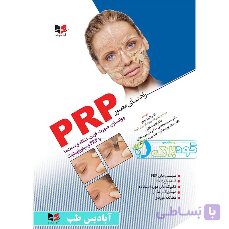 راهنمای مصور پی آر پی | PRP — تصویر 1