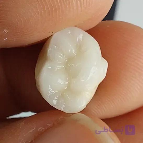 دوره آنلاین ثابت – دوره آنلاین تخصصی پروتز ثابت PFM — تصویر 1