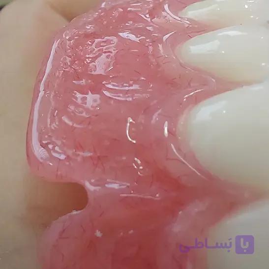 دوره آنلاین متحرک پروتزهای دندانی — تصویر 1