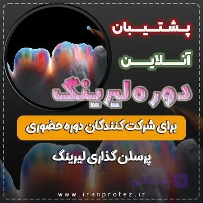 پشتیبان دوره حضوری پرسلن گذاری لیرینگ