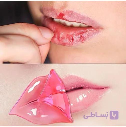 ماسک لب ورقه ای نرم کننده و کلاژن ساز کد LIP4 — تصویر 1
