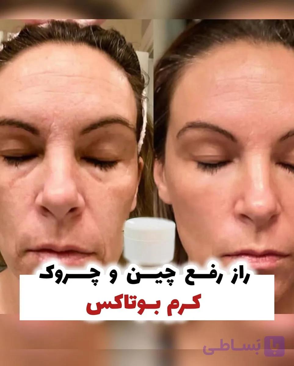 کرم ضد چین چروک و سفت کننده بوتاکس ایجلس