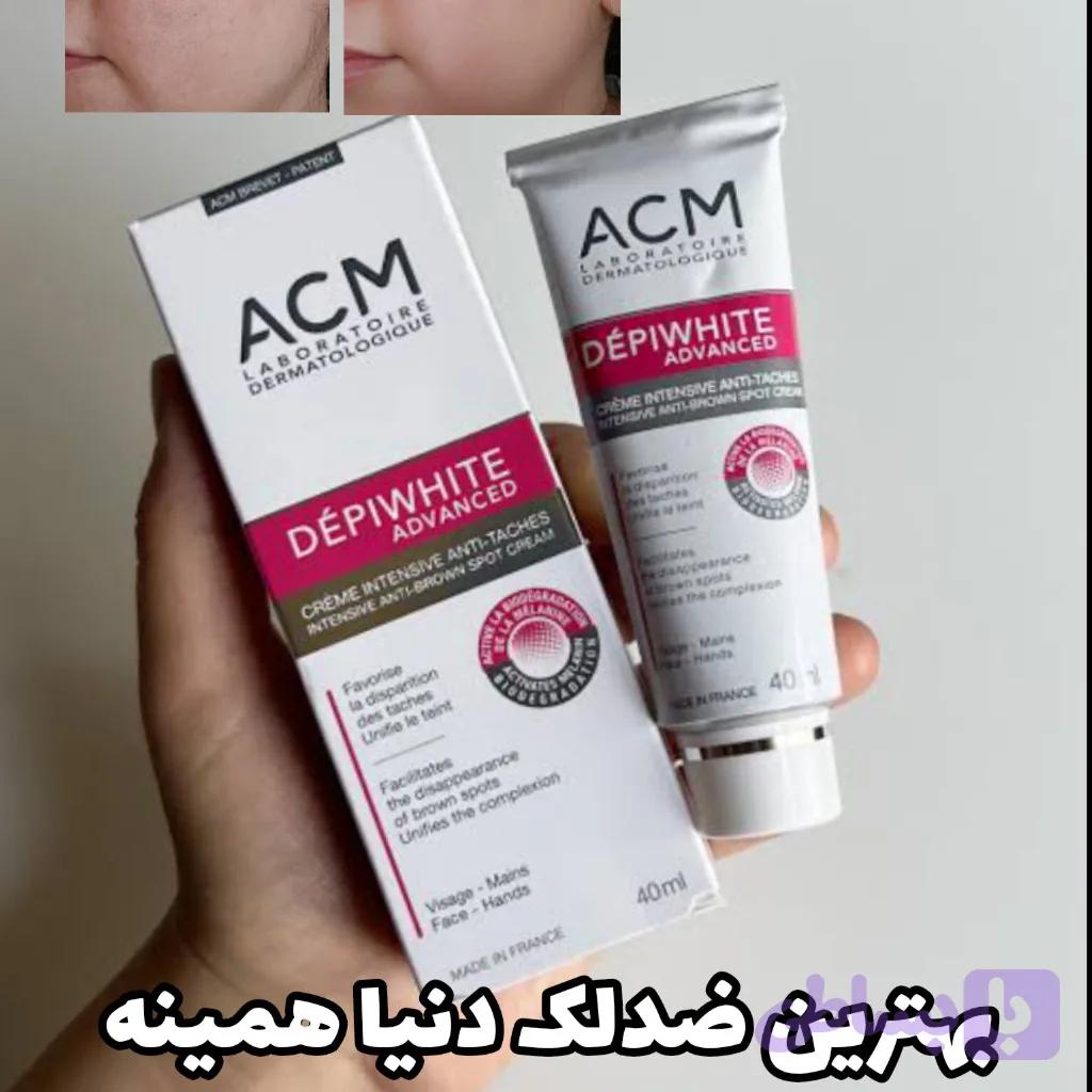 کرم ضدلک acm اورجینال
