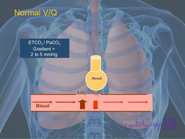دانلود اسلایدها و پادکست های وبینار پایش های تنفسی در بیماران کووید۱۹(Respiratory Monitoring in COVID-19 Patients) — تصویر 1