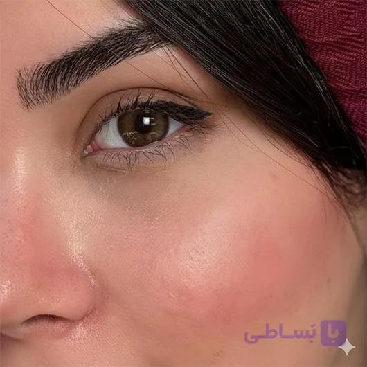 لنز طبی رنگی رز قهوه ای عسلی دور دار Orkid Brown — تصویر 1