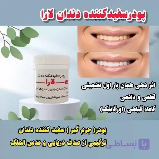 پودر سفید کننده دندان یارا اصل با ارسال رایگان