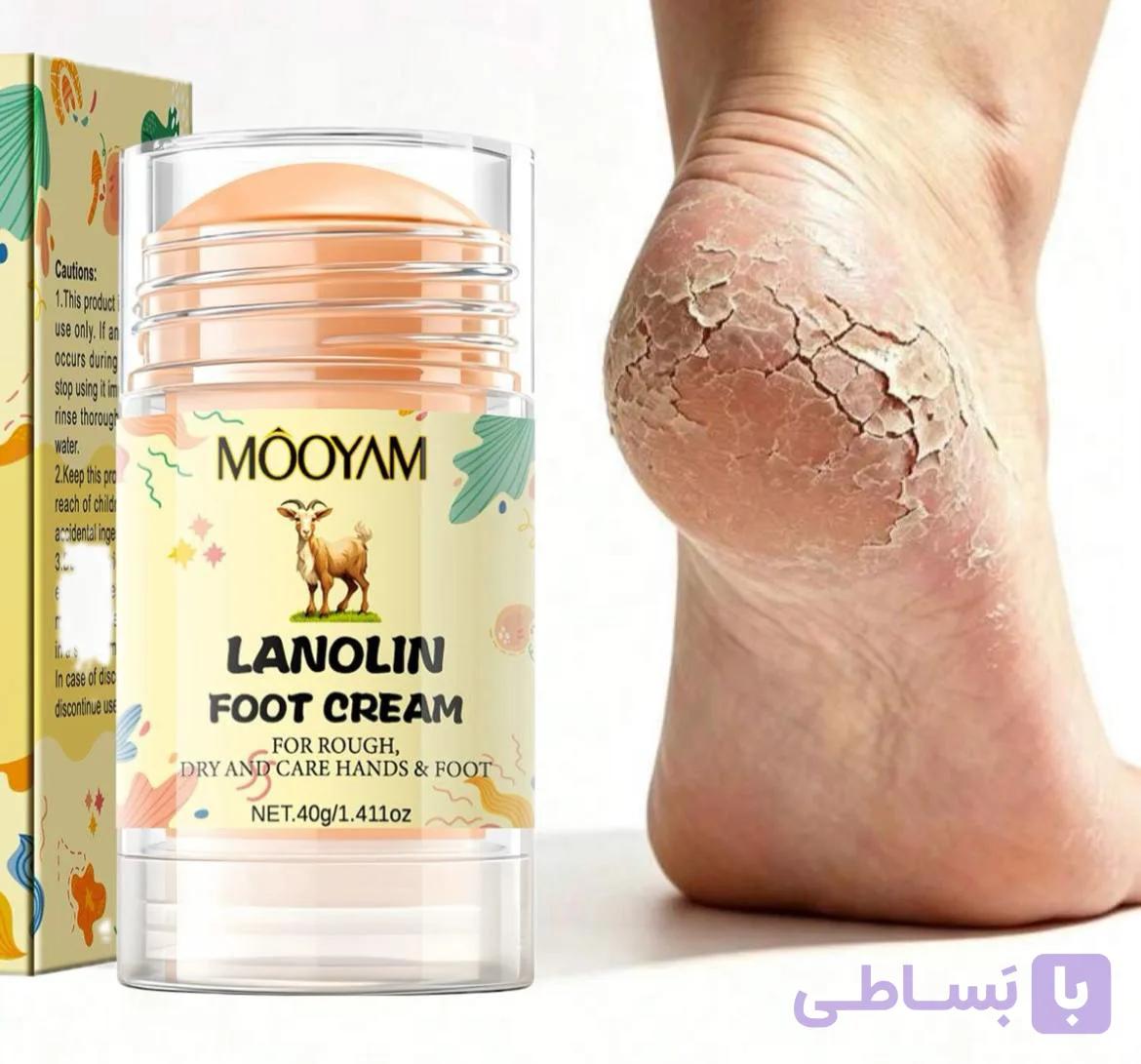 کرم استیکی ترک پا — تصویر 1