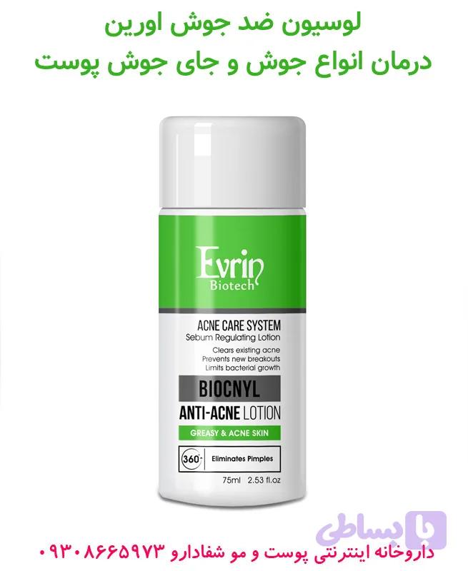 لوسیون ضد جوش اورین