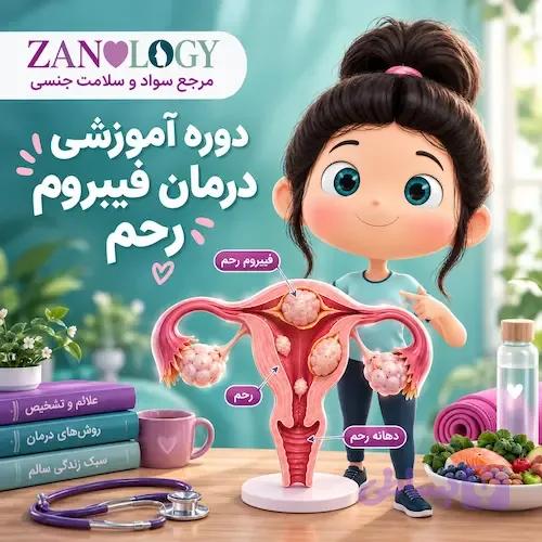 درمان فیبروم رحم با اصلاح سبک زندگی(بدون جراحی) — تصویر 1