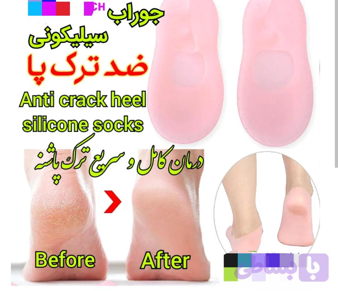جوراب ژله ای، درمان ترک پا، میخچه، نتیجه عالی😍