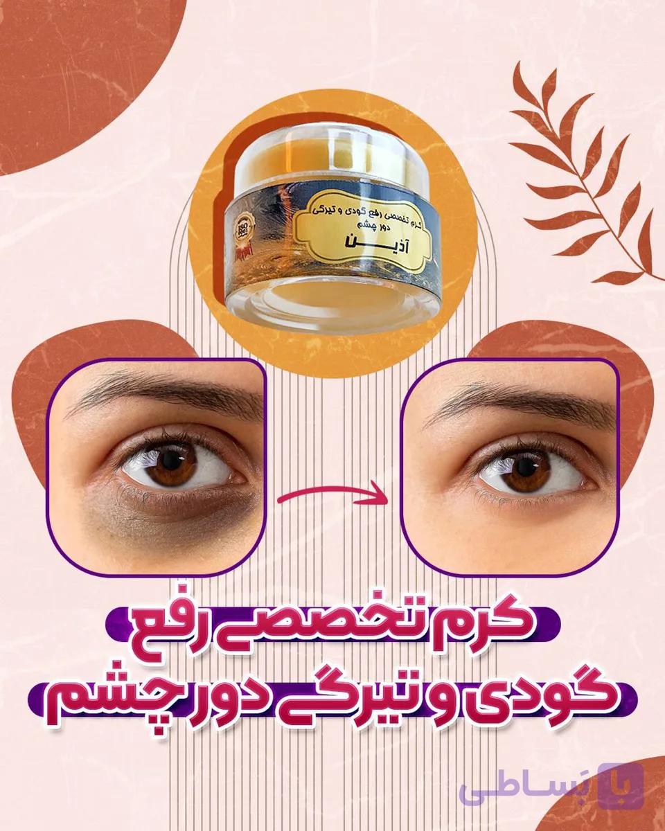 کرم رفع گودی و تیرگی و مراقبت دور  چشم اذین